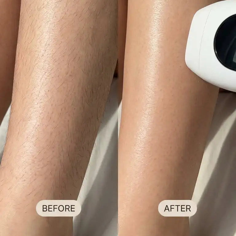 IPL Pro hair removal 1 million flashs